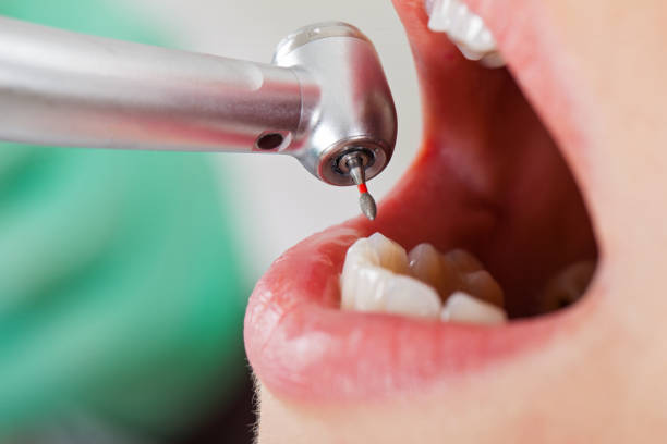Best Emergency Dentist for Lost Fillings or Crowns in Lockport Heights, IL